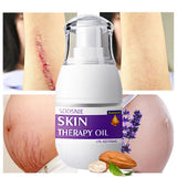 Aceite para el tratamiento de la piel, elimina las perforaciones, la celulitis, las estrías y repara el cuidado corporal 30 ml